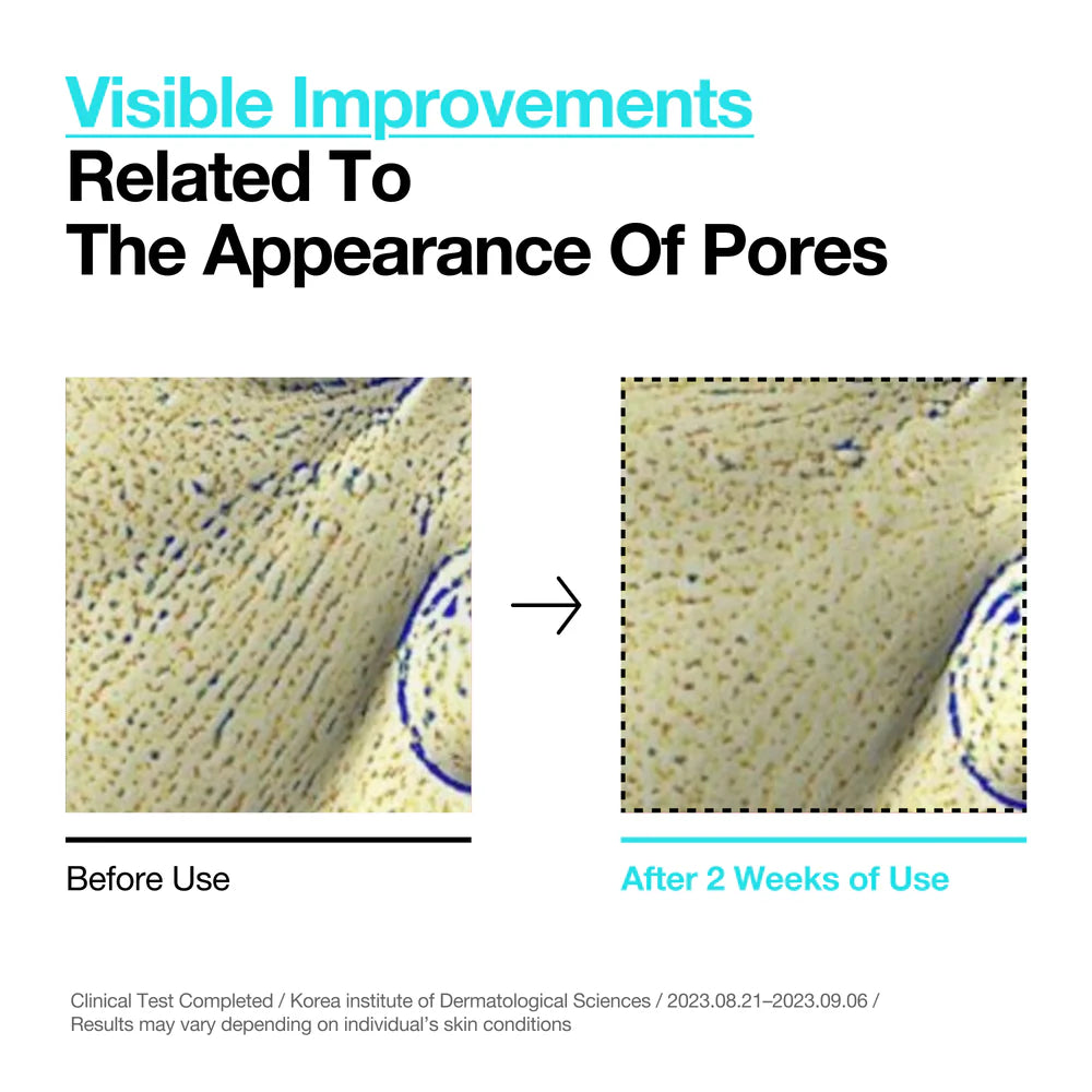 Anua BHA 2% kooriva tooniku tekstuur