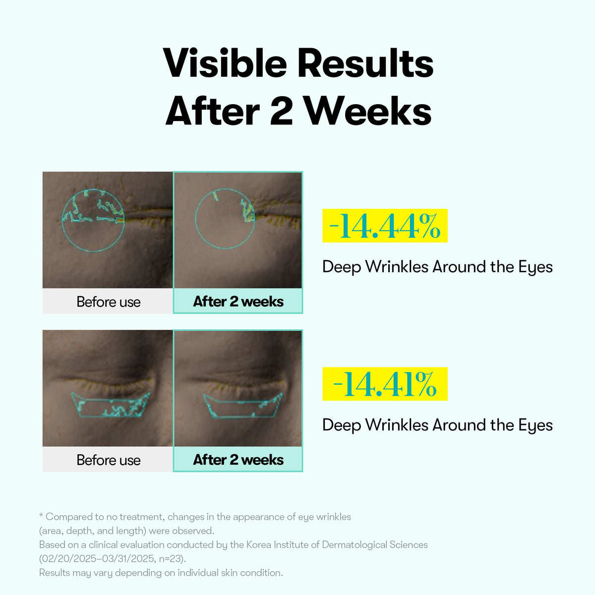 VT Cosmetics PDRN Reedle Shot Eye Lifter - vibreeriv pinguldav silmakreem 15ml